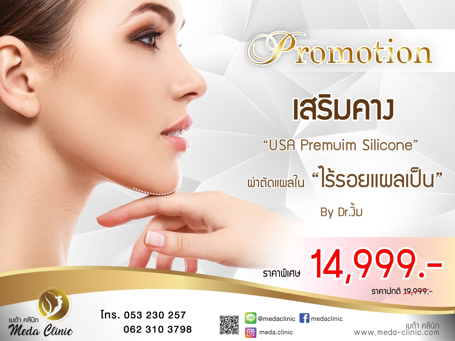 เสริมคาง