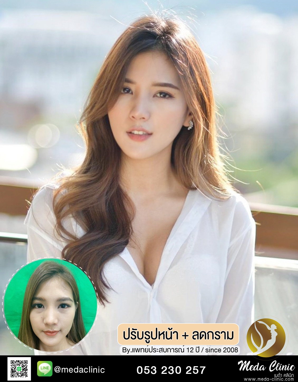 ปรับรูปหน้า+ลดกราม