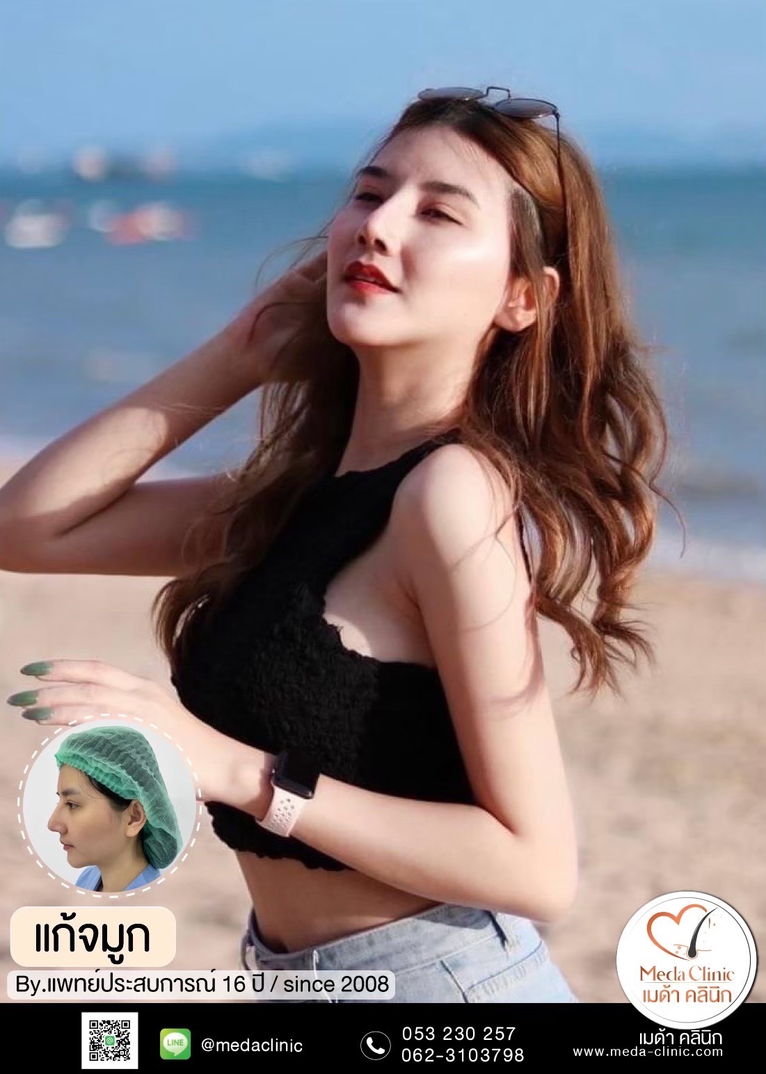 เสริมจมูก