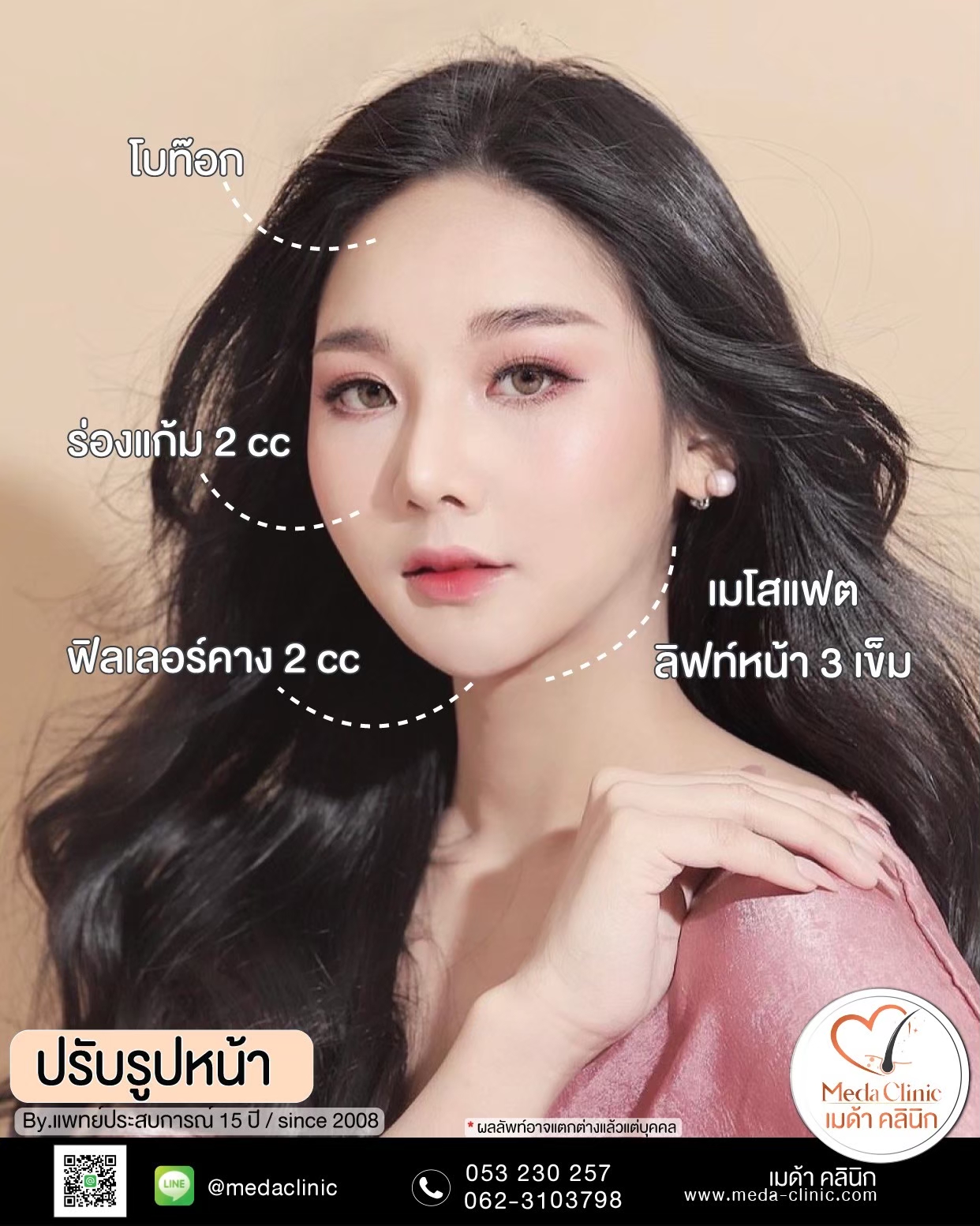 เมโสแฟตคืออะไร?