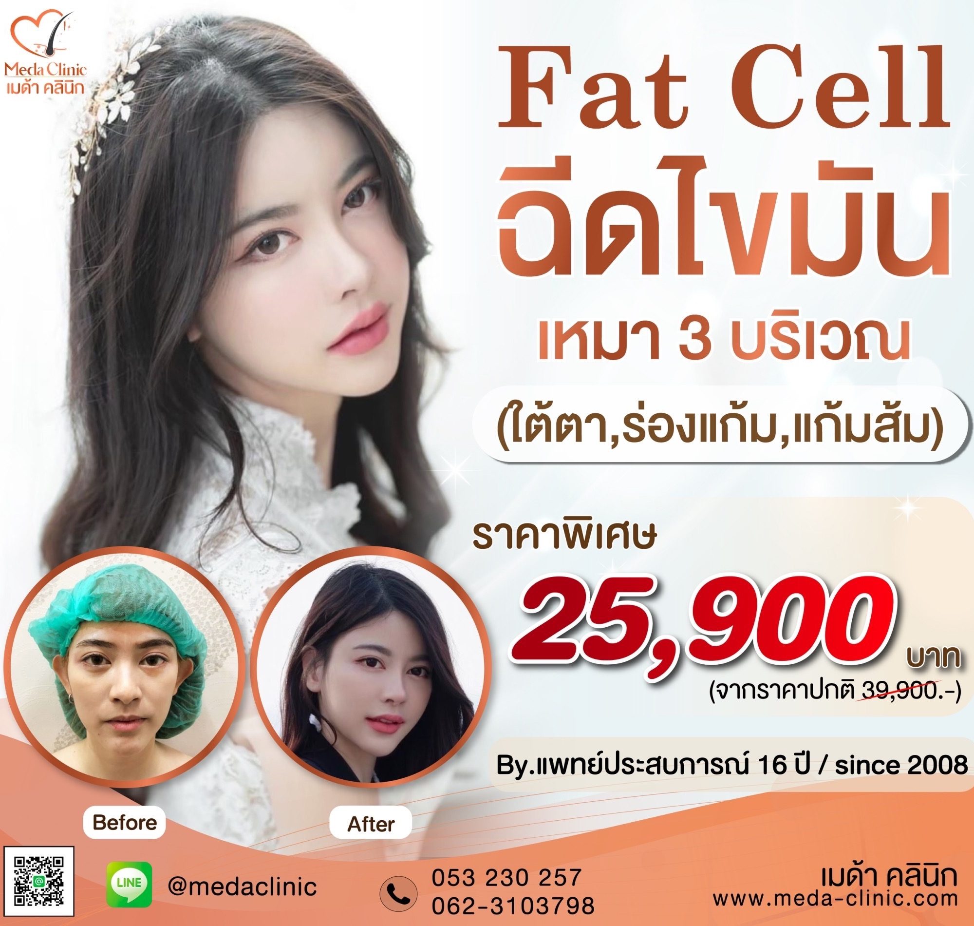 ฉีดไขมัน