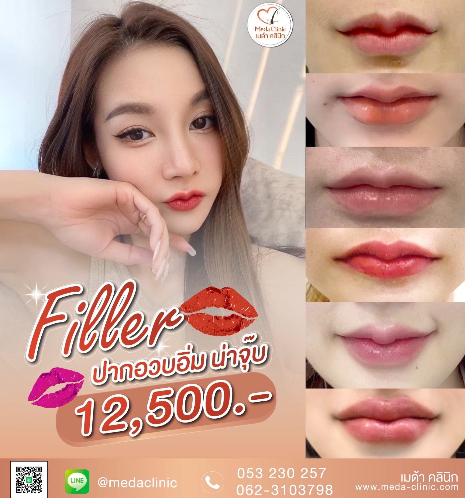 filler