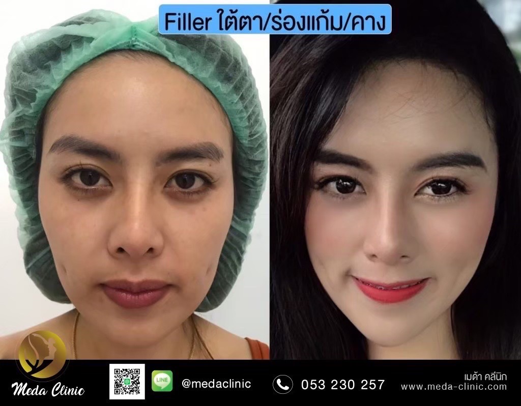 S__95969500_0 - Copy