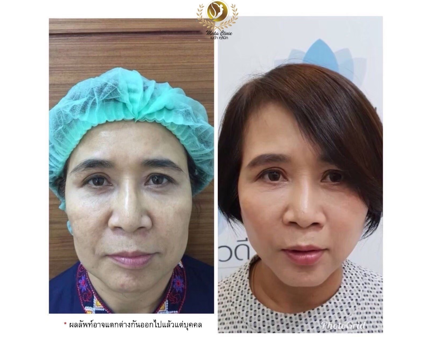 ดีไซน์ที่ยังไม่ได้ตั้งชื่อ (16)