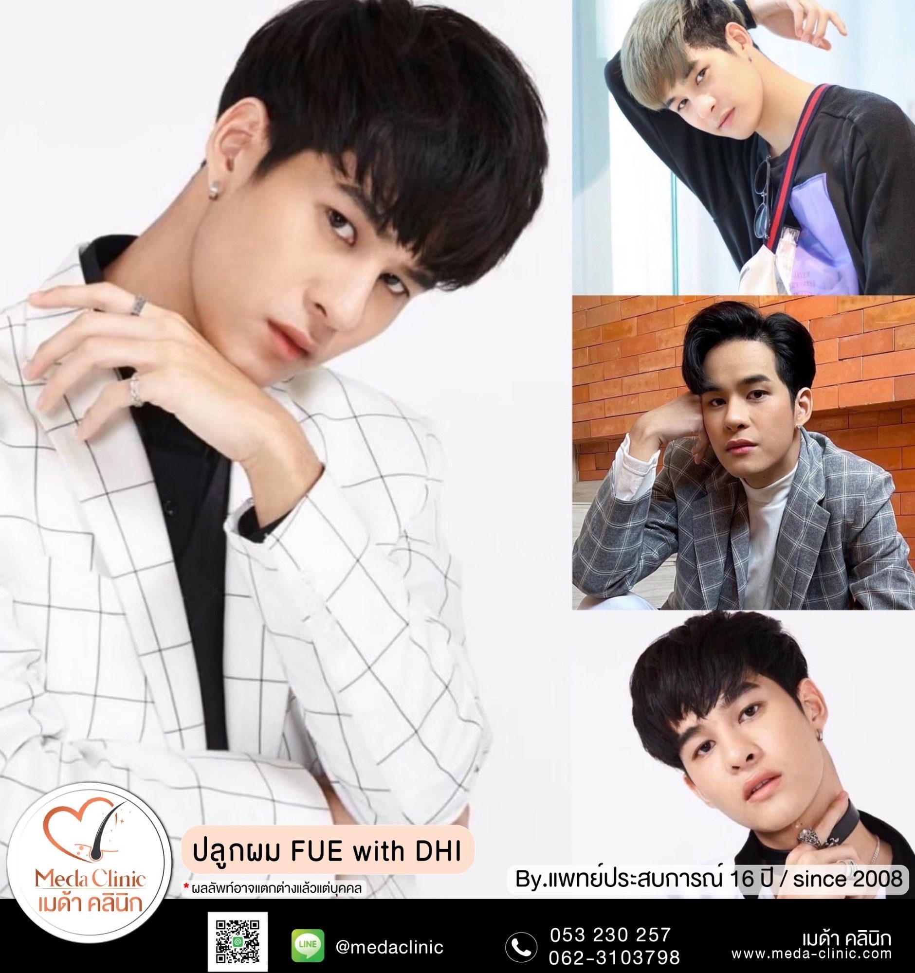 ปลูกผมถาวร