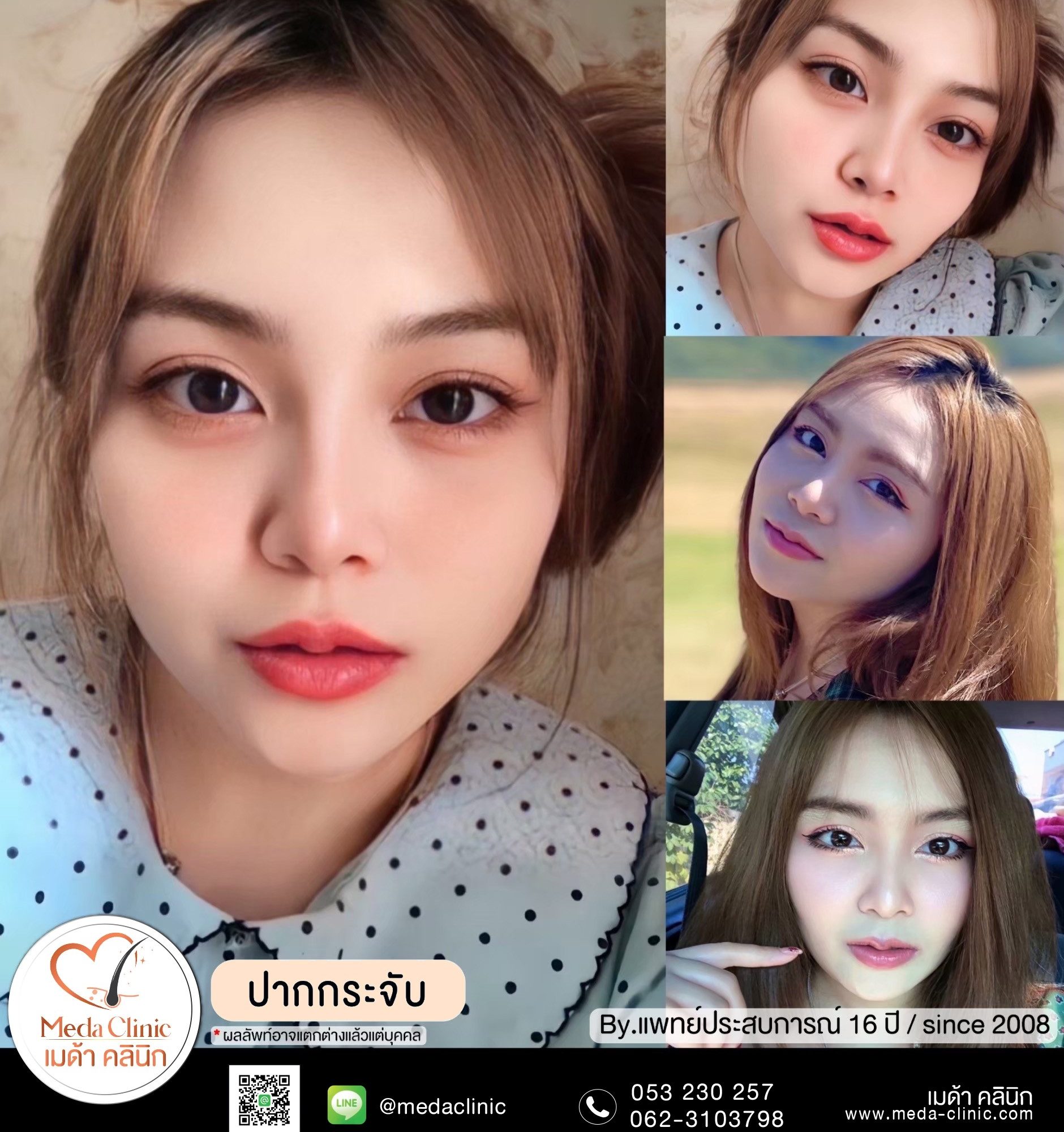 ทำปากกระจับเชียงใหม่