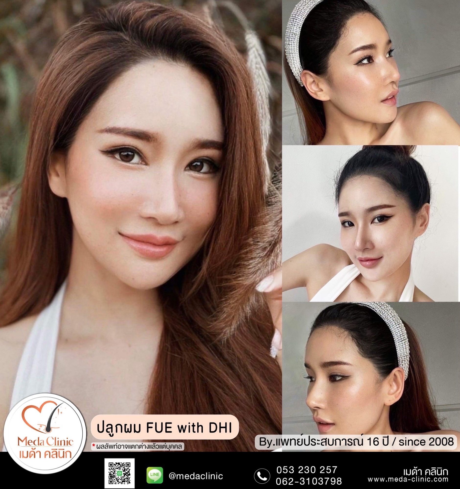 ปลูกผมที่ไหนดี