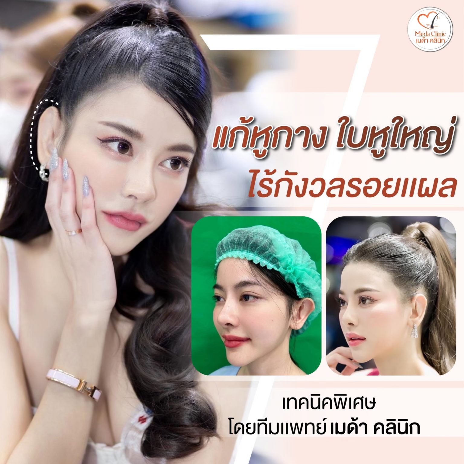 แก้หูกาง ดรุงเทพ