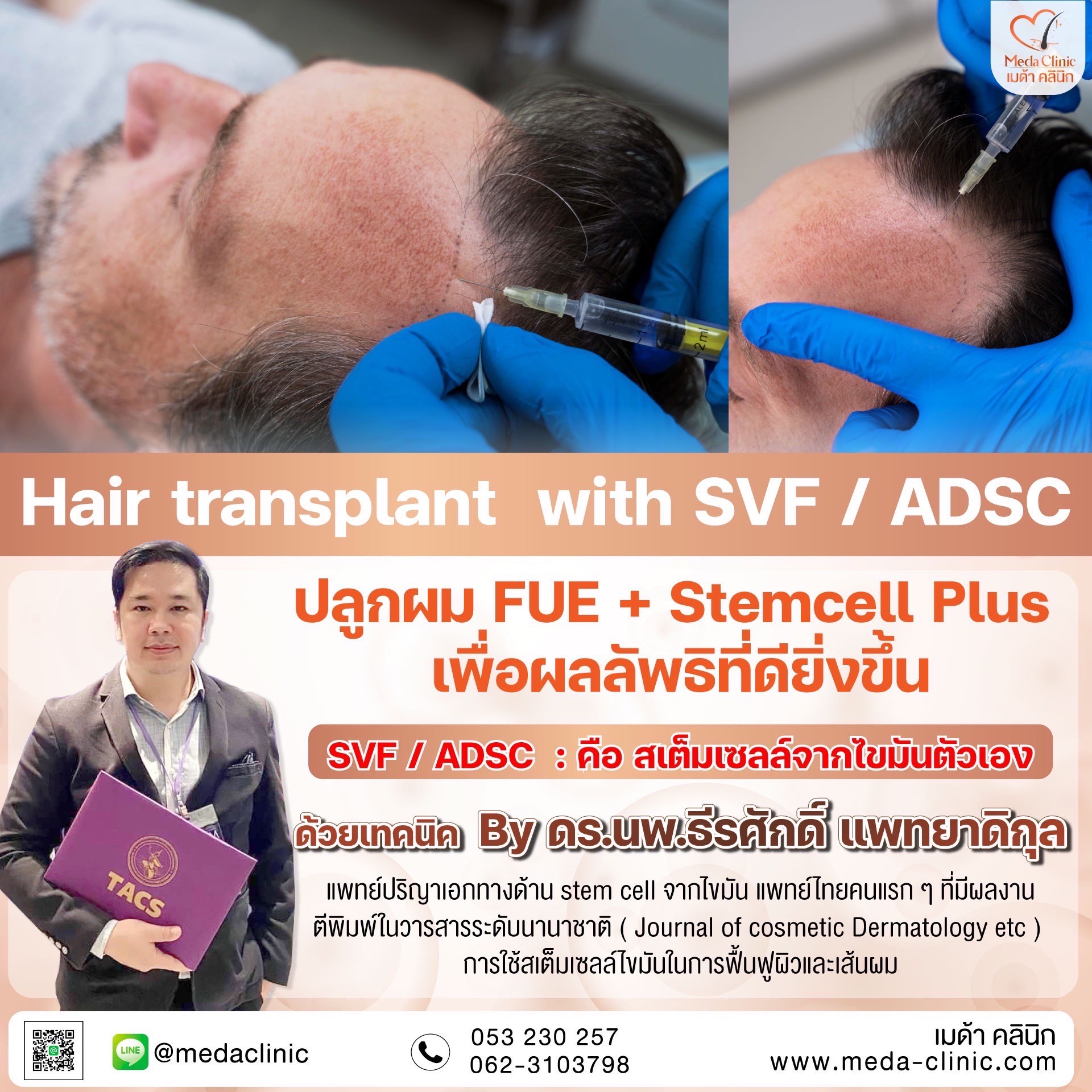 fue+ stemcell plus