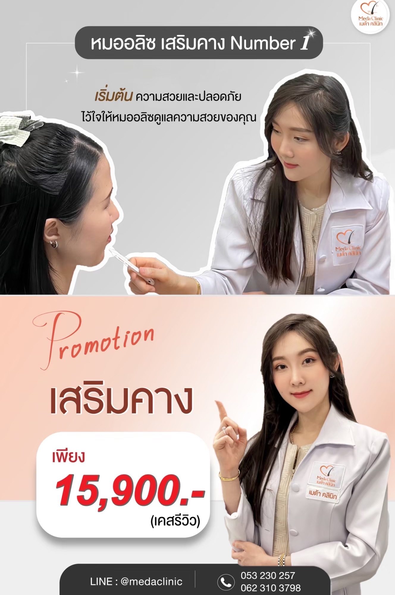 โปรเสริมคาง