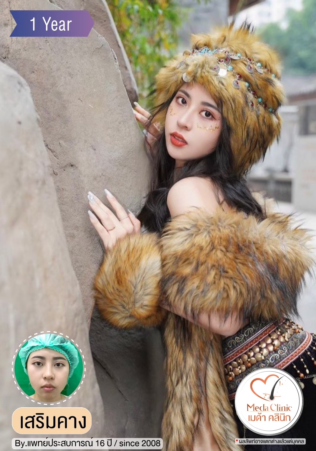 แก้คางเชียงใหม่