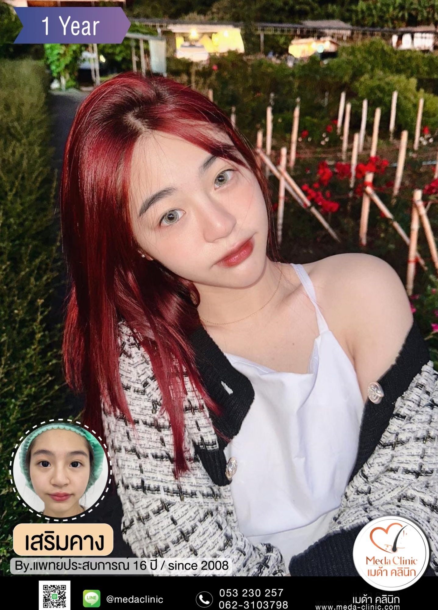 แก้คางเชียงใหม่
