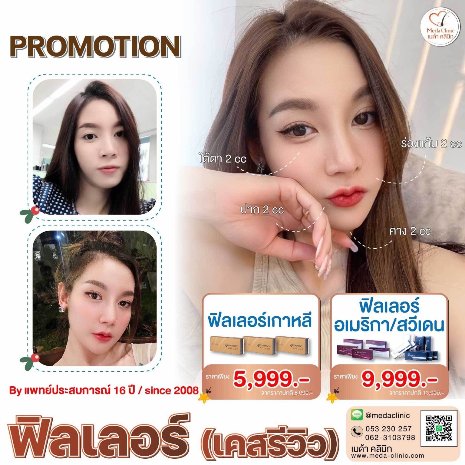 ฟิลเลอร์ปากเชียงใหม่