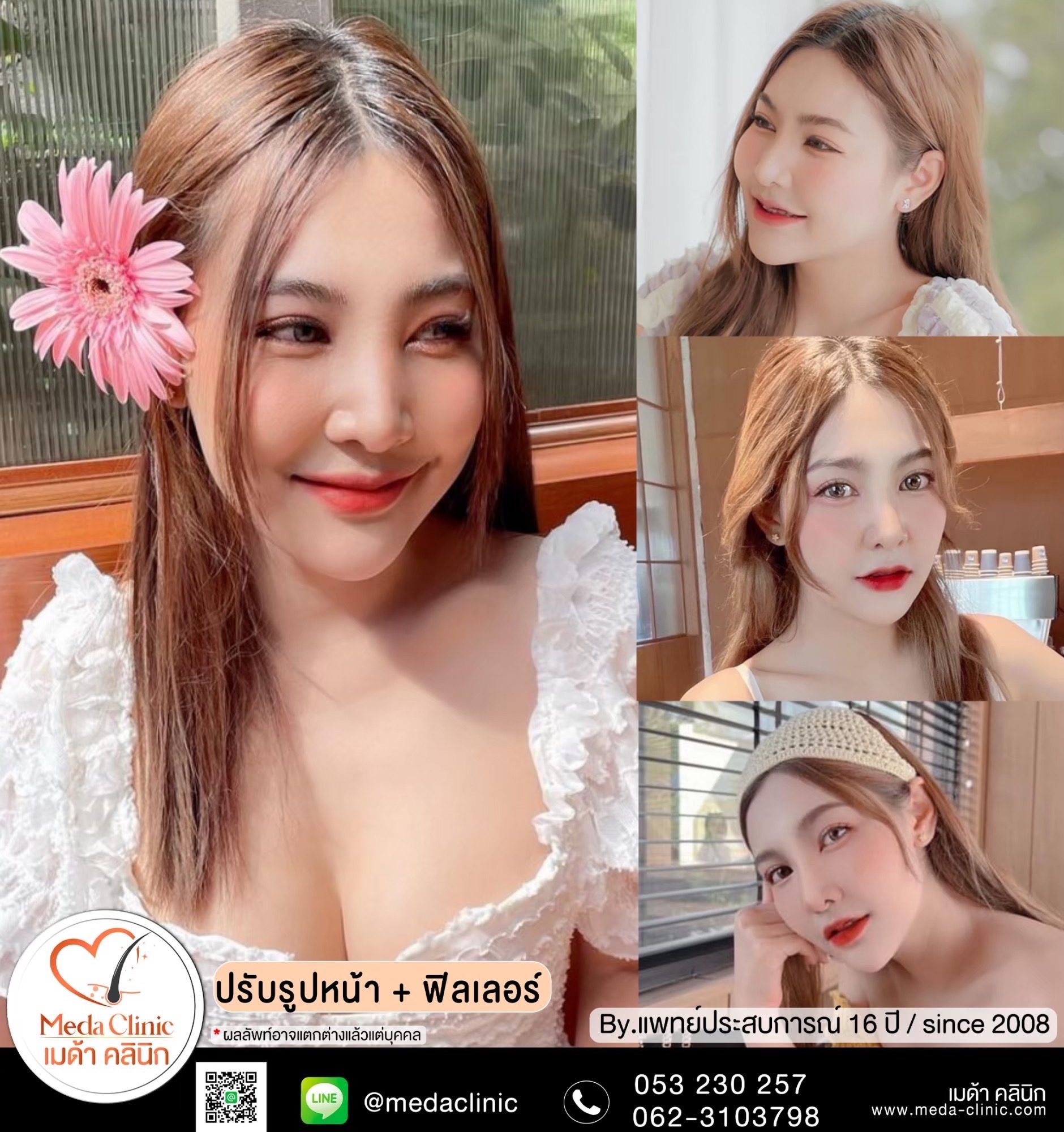 ฟิลเลอร์ปากเชียงใหม่