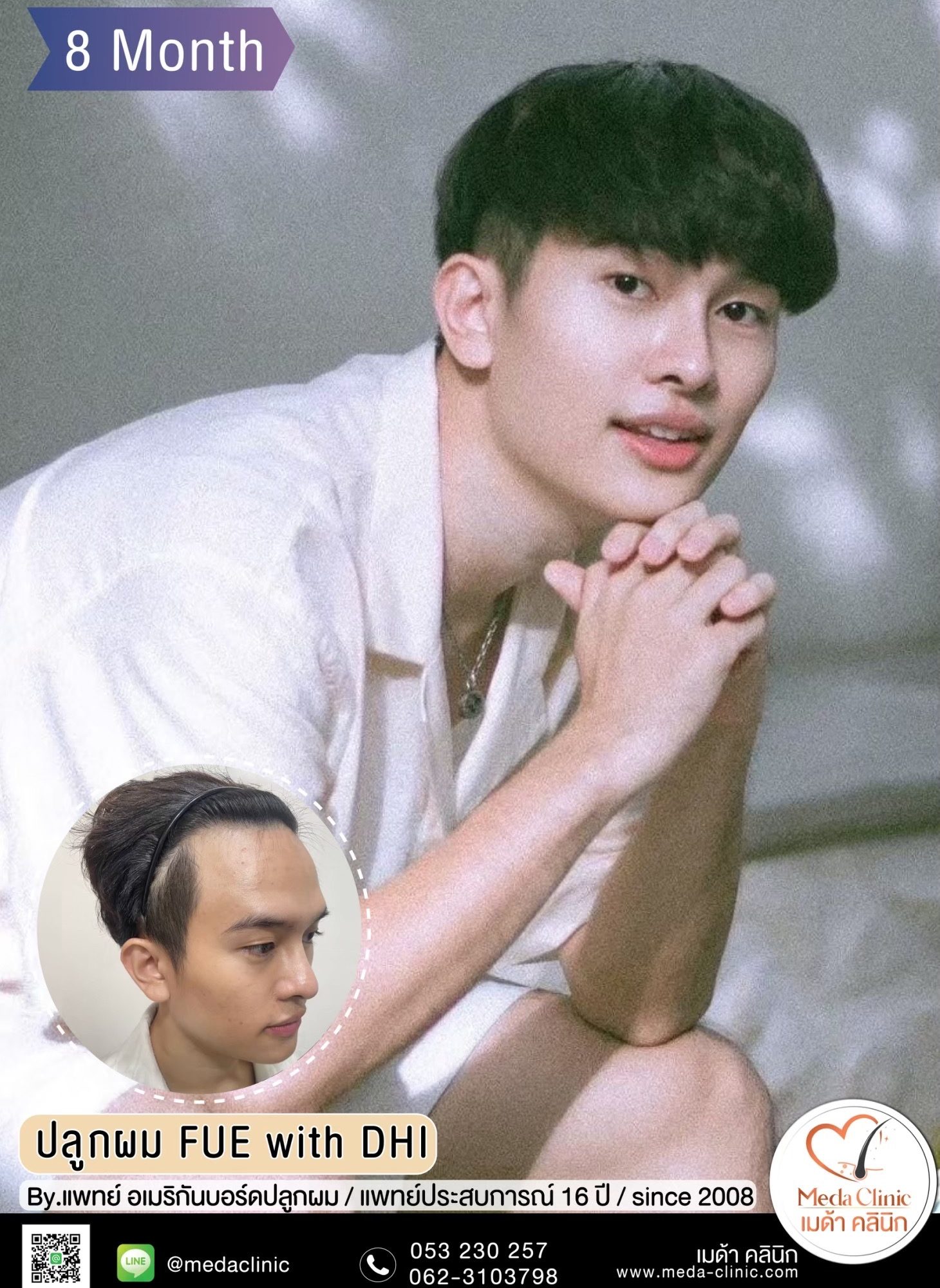 ปลูกคิ้ว เชียงใหม่