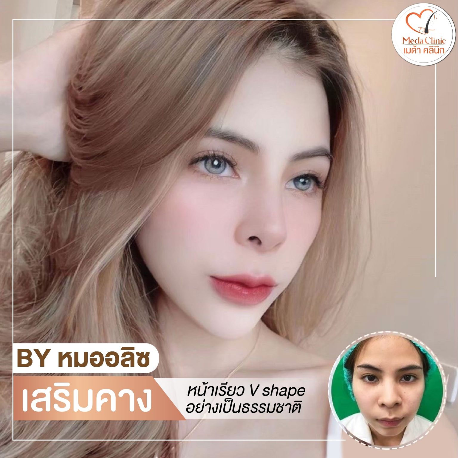 คลินิกศัลยกรรมเชียงใหม่
