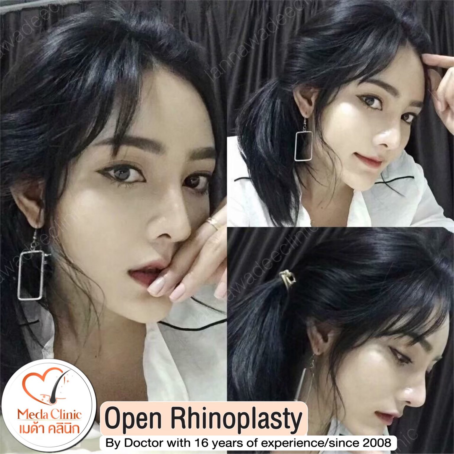Plastic surgery Chiangmai