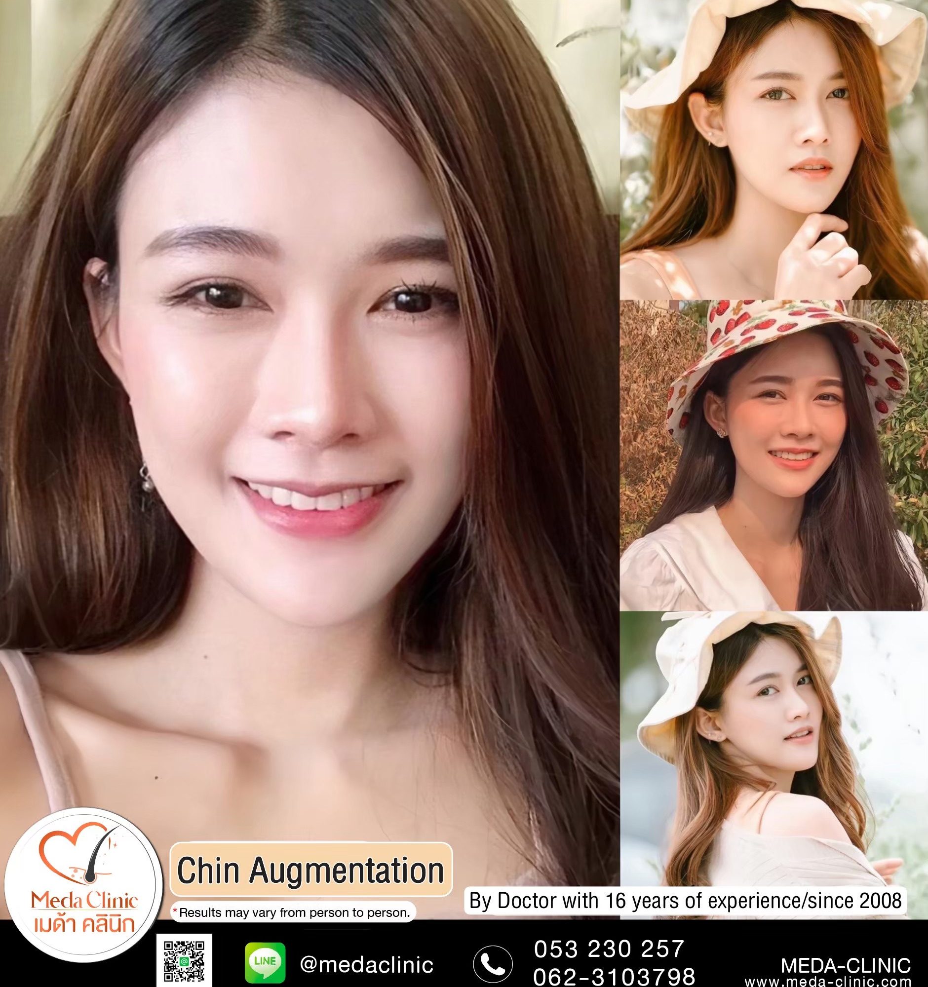 plastic-surgery