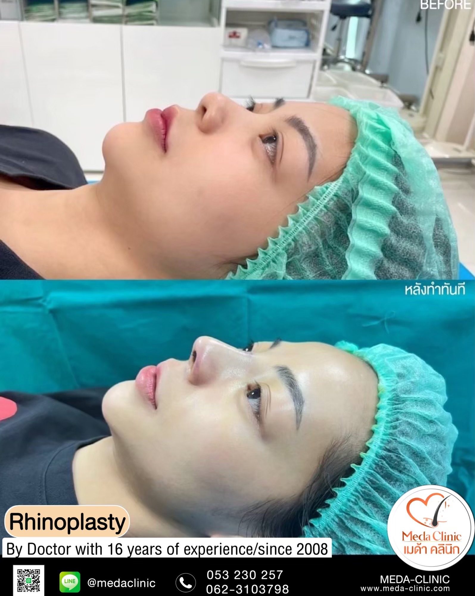 Plastic surgery Chiangmai