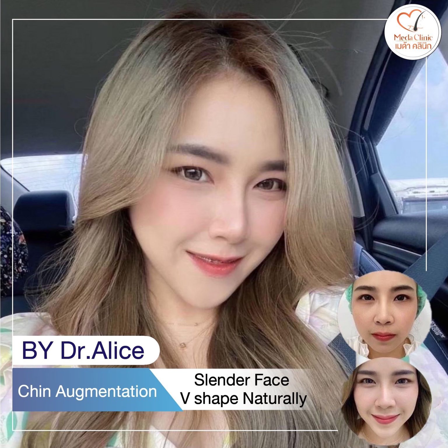 Plastic surgery Chiangmai