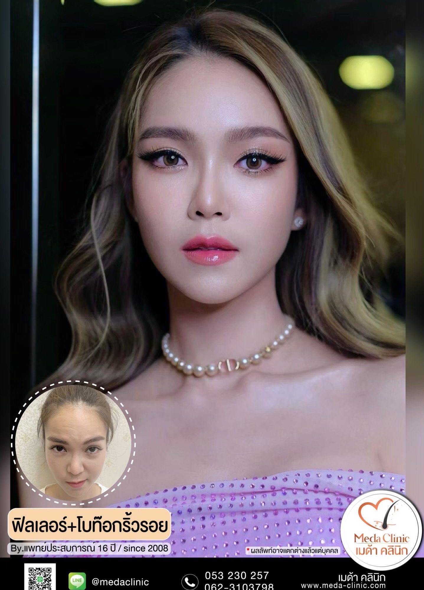 ฉีดโบท๊อกที่ไหนดี
