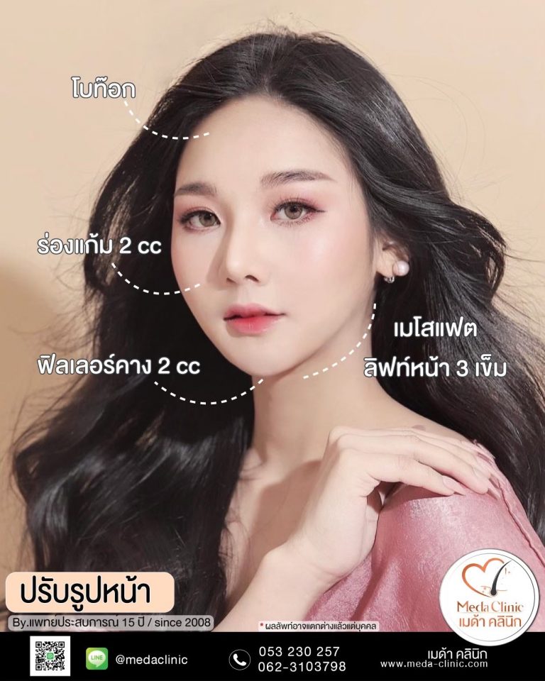 ฉีดโบท๊อก