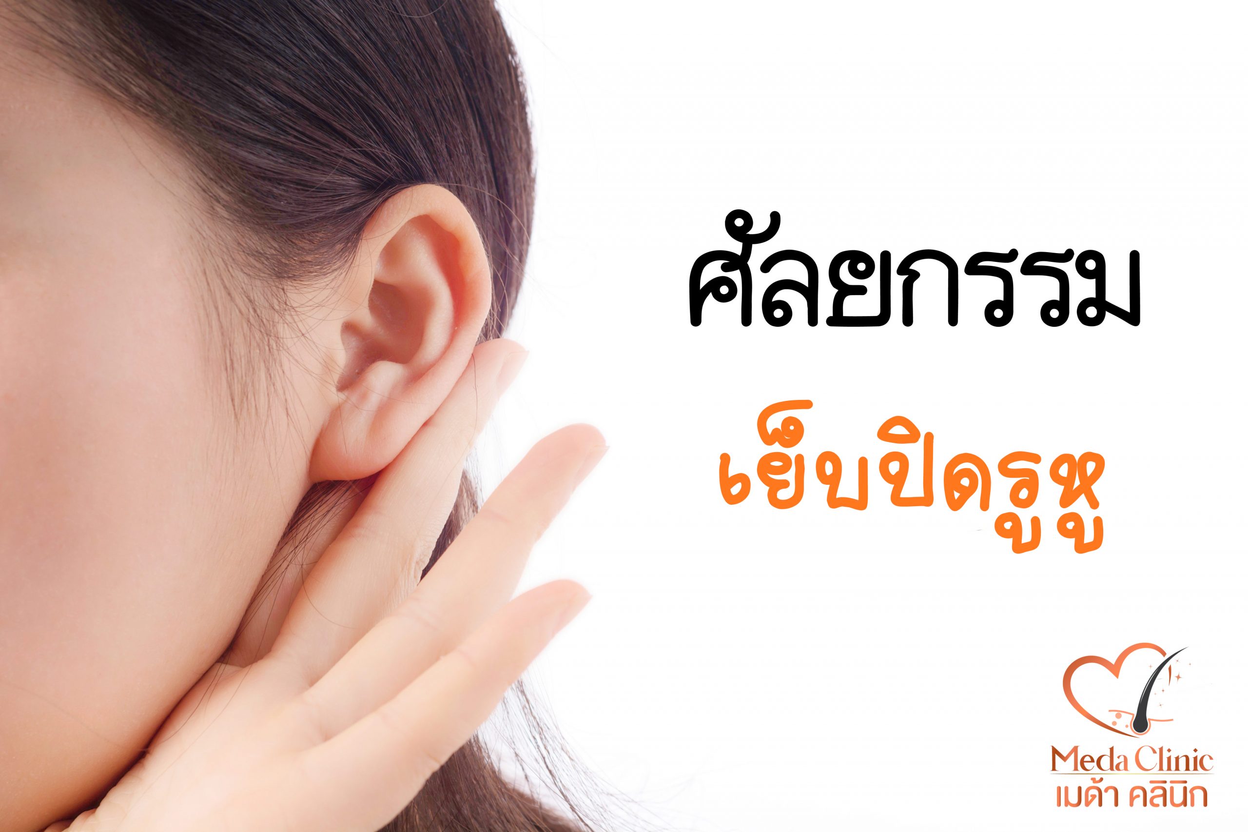 การเย็บปิดรูหู