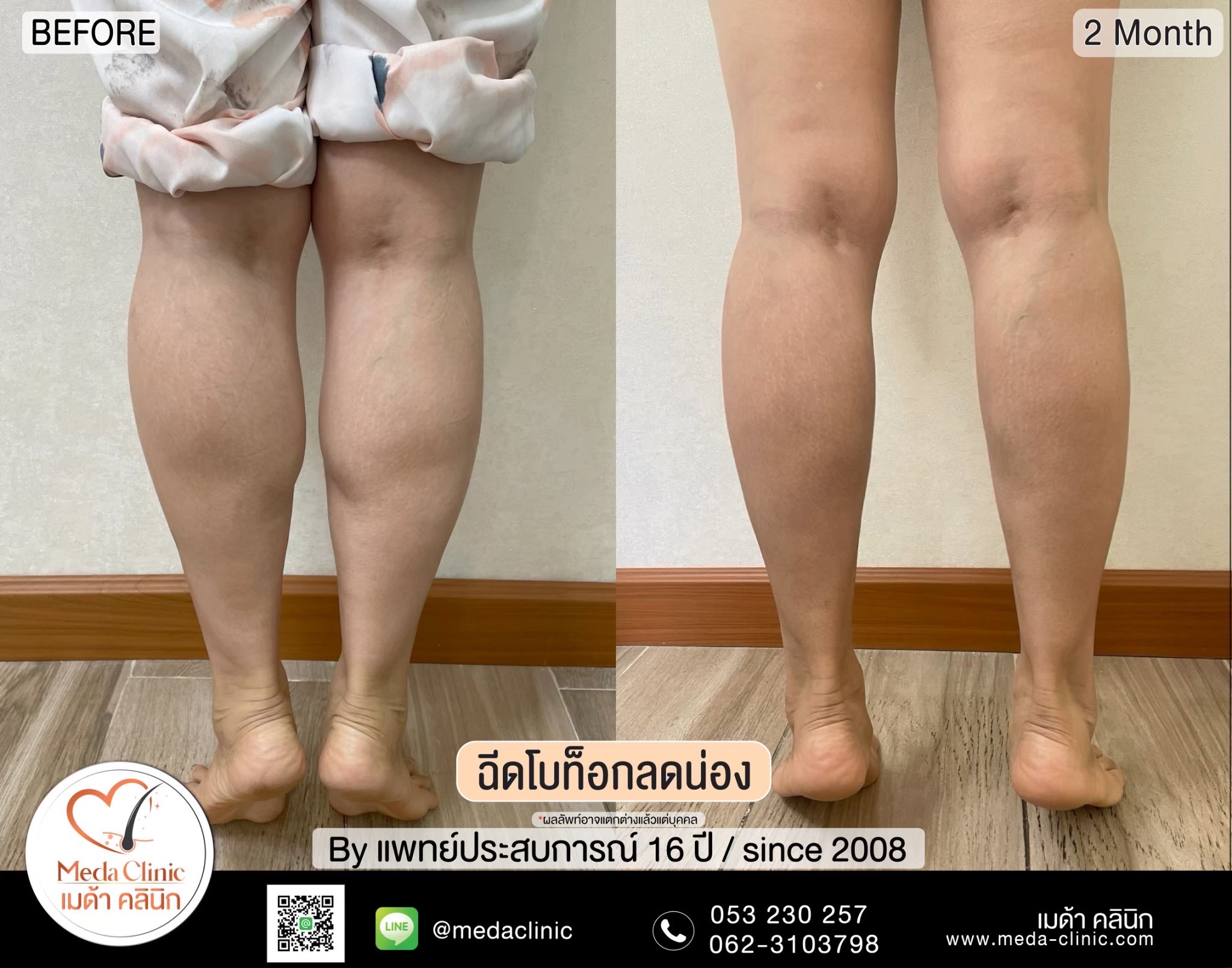 โบท๊อกน่อง