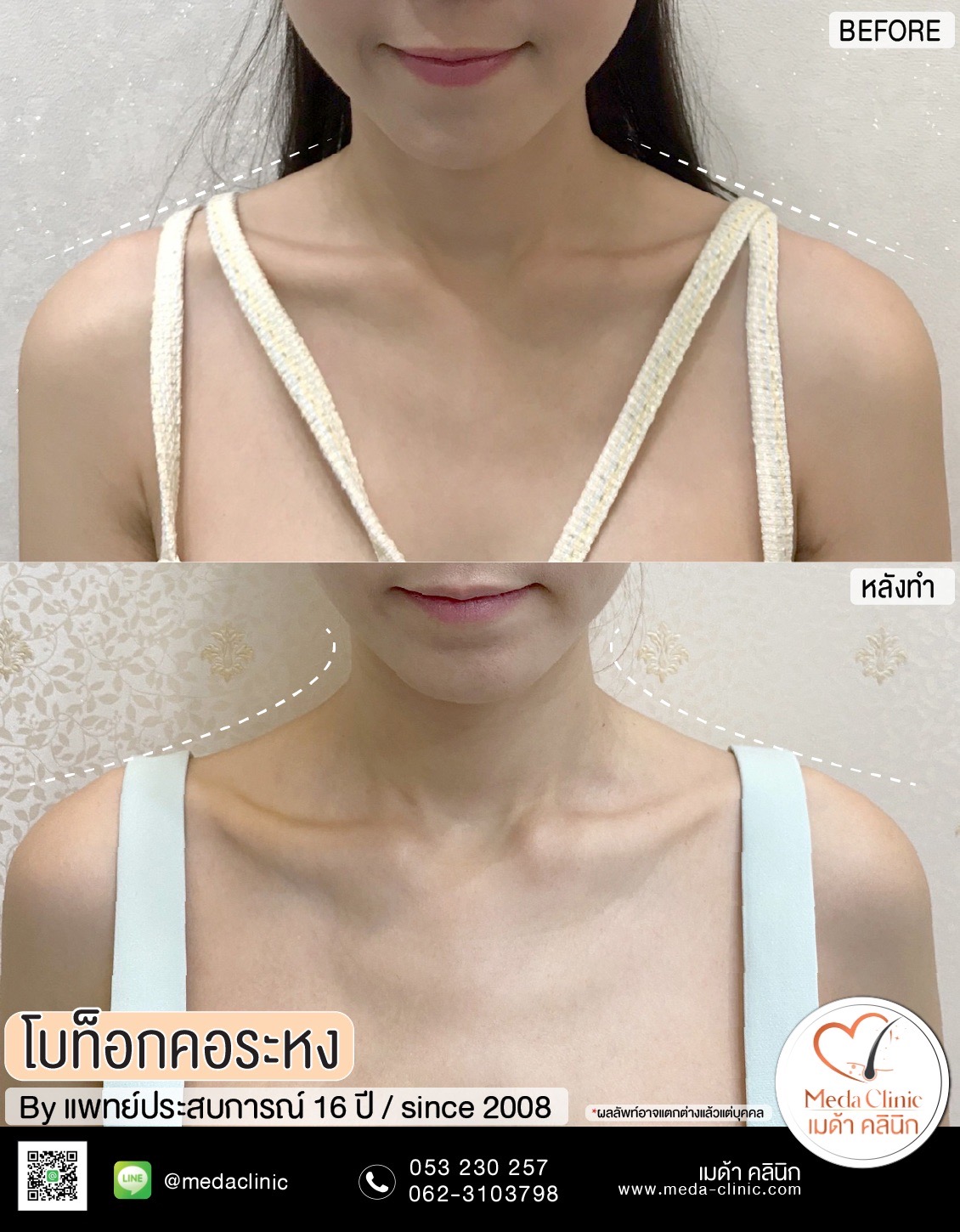 คอระหง