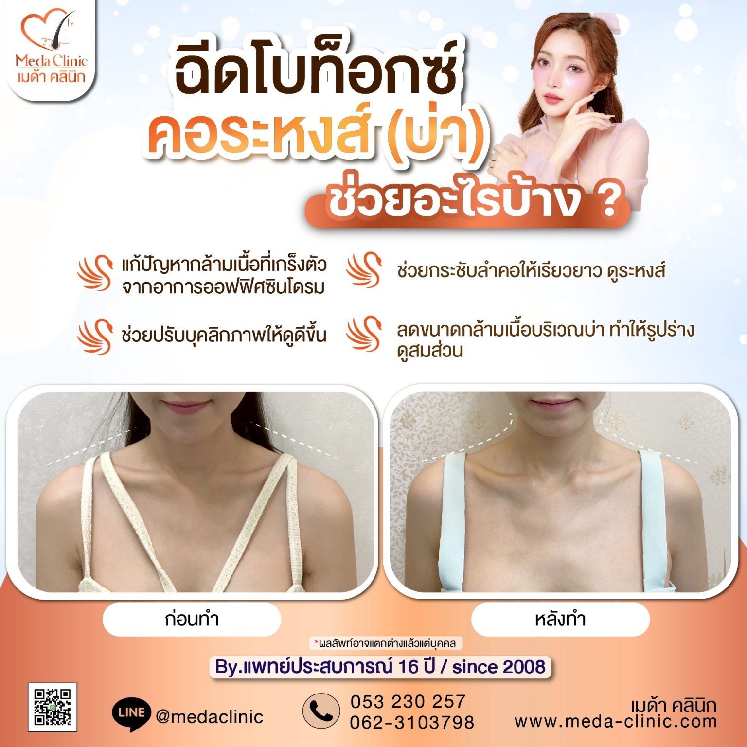 ฉีดคอระหงเชียงใหม่