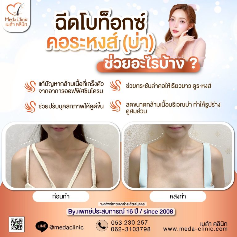 ฉีดคอระหงเชียงใหม่