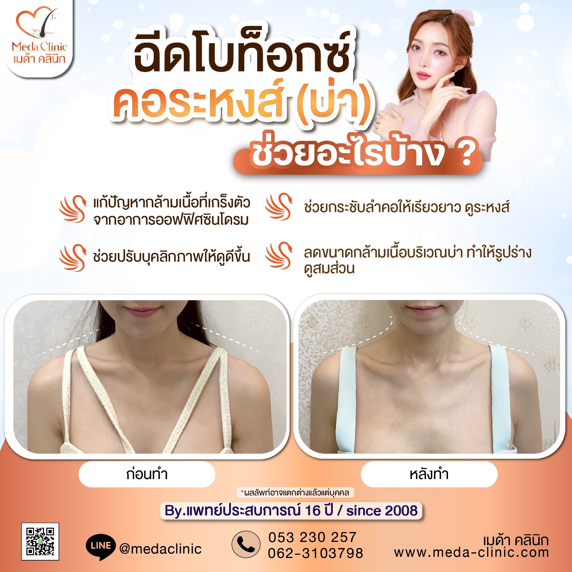 ฉีดคอระหงเชียงใหม่
