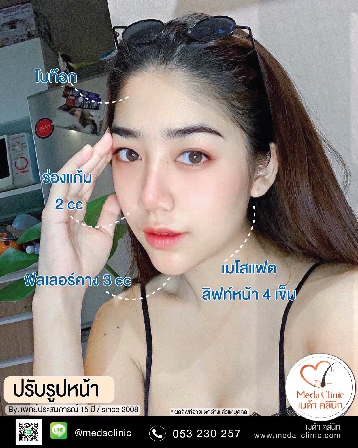 ฉีดคอระหงเชียงใหม่