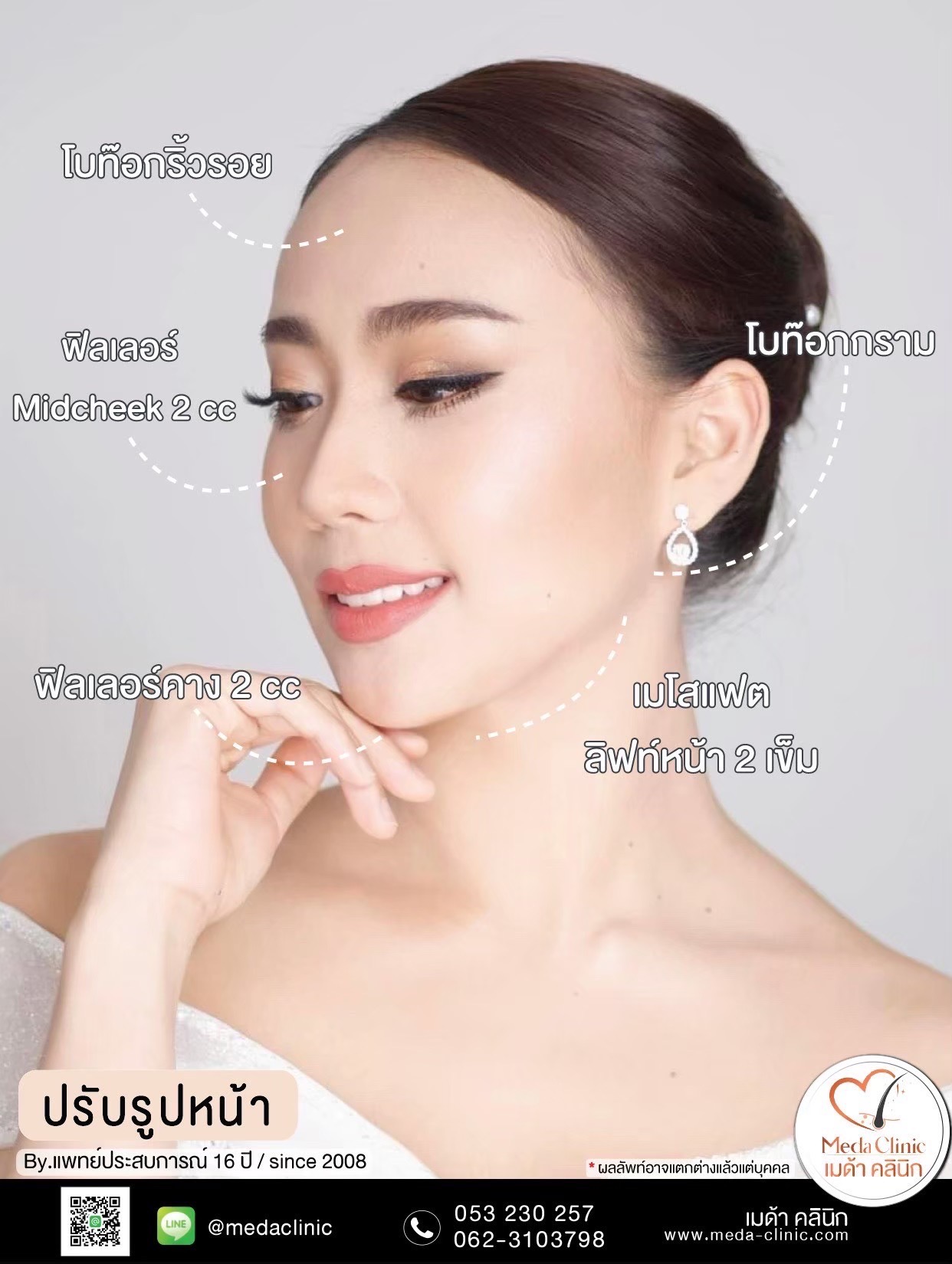 ฉีดคอระหงเชียงใหม่