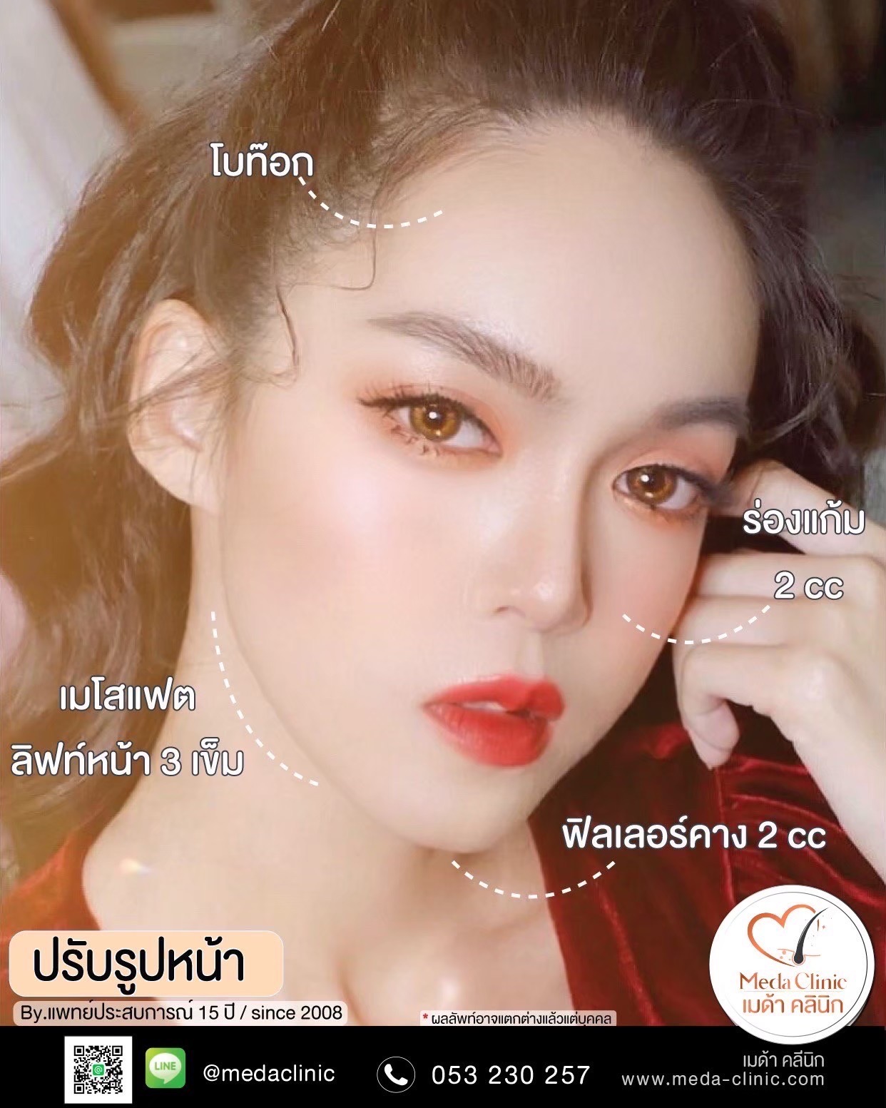 ฉีดคอระหงเชียงใหม่