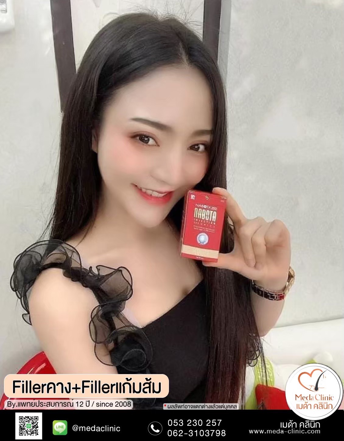 ฉีดโบท็อกซ์น่อง