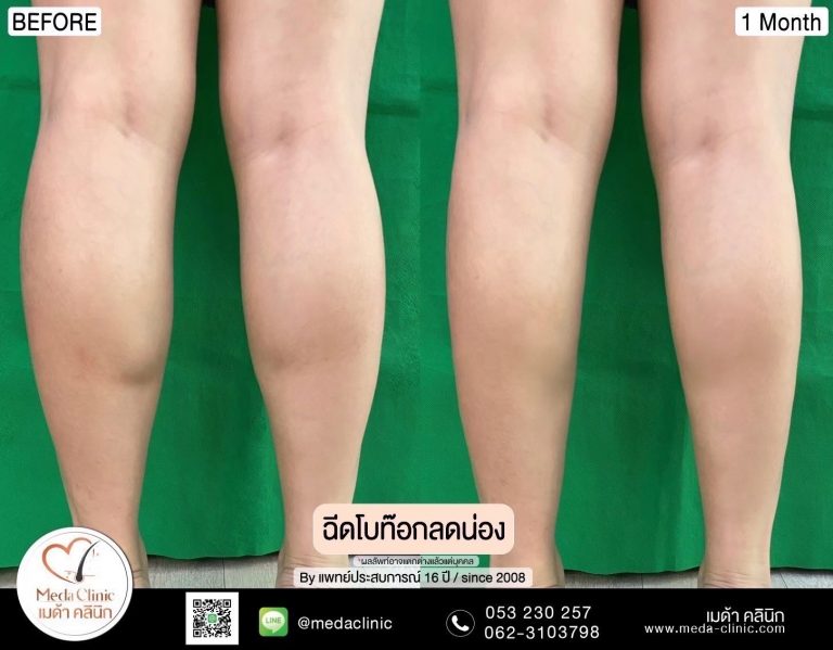 โบท๊อกน่อง