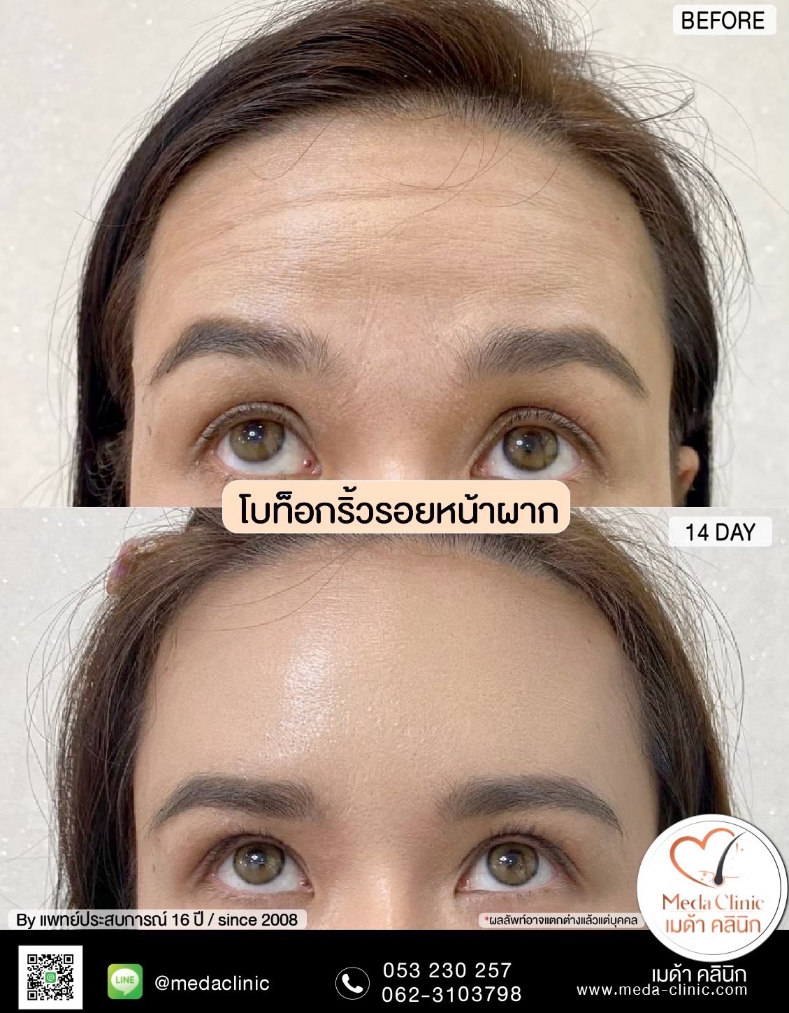 โบท็อกลดน่องเชียงใหม่