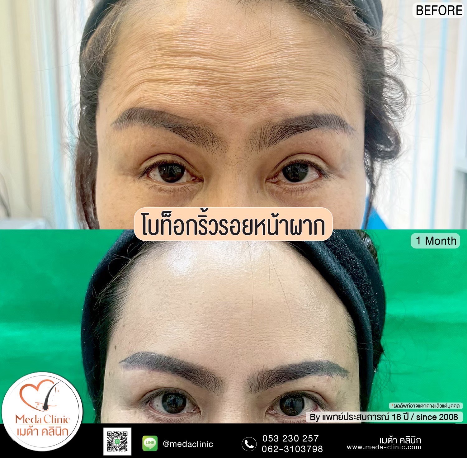 โบท็อกลดน่องเชียงใหม่