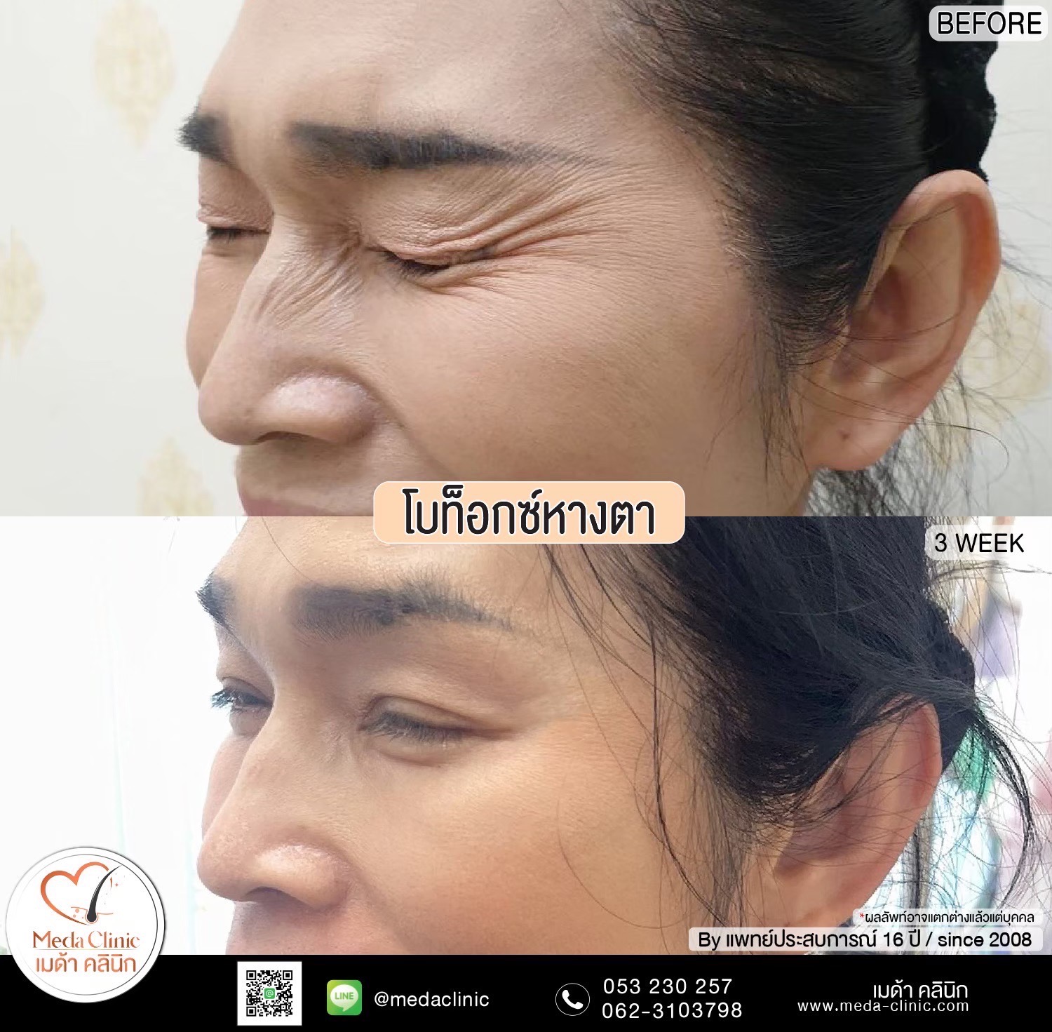 โบท็อกลดน่องเชียงใหม่