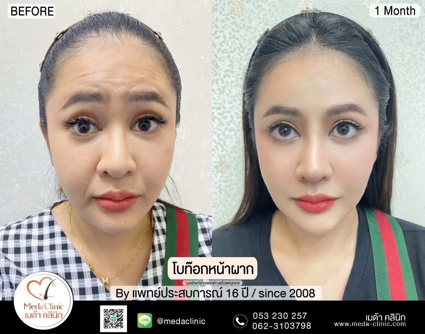 โบท็อกลดน่องเชียงใหม่