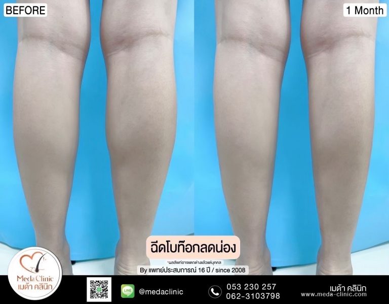 โบท็อกลดน่องเชียงใหม่