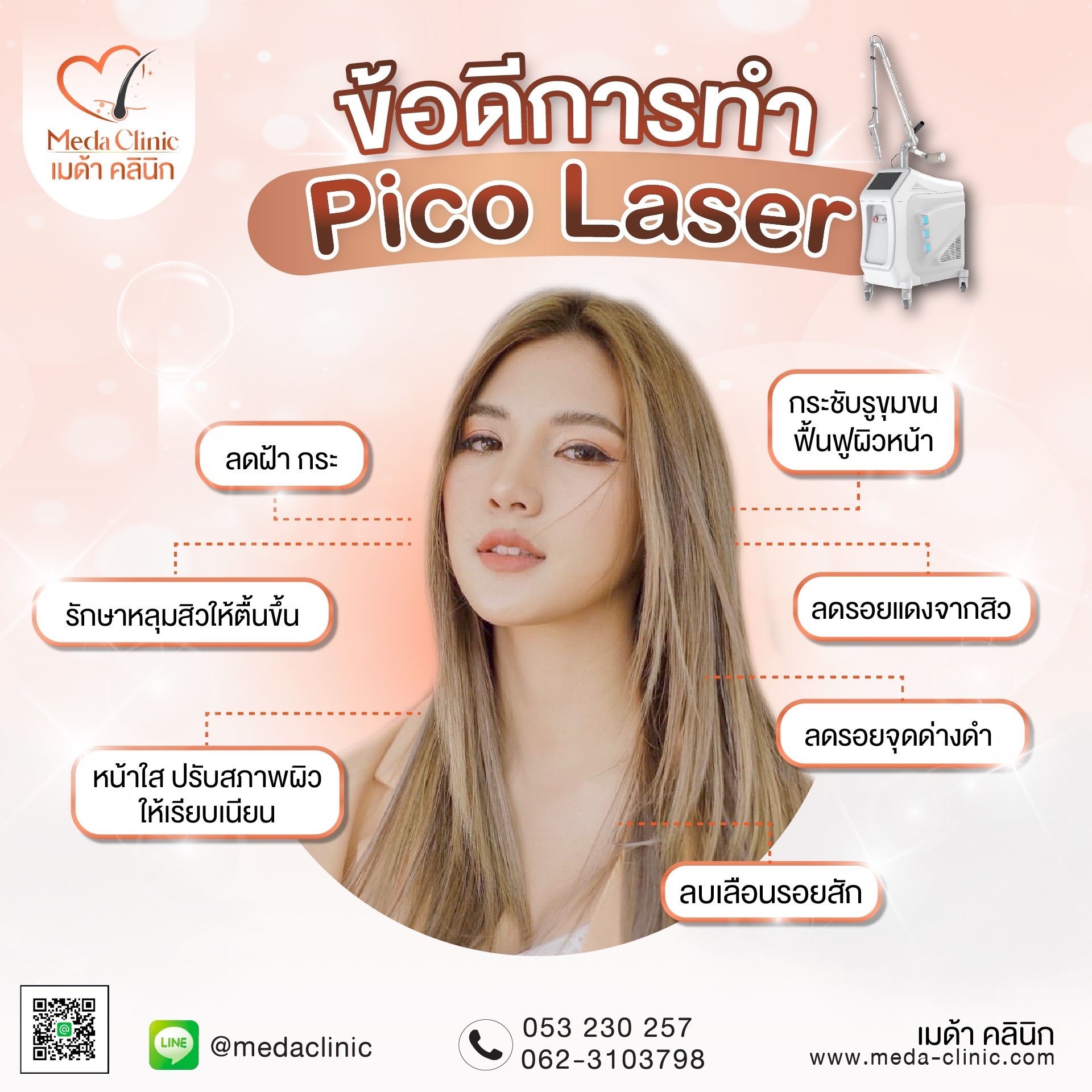 เลเซอร์หลุมสิว
