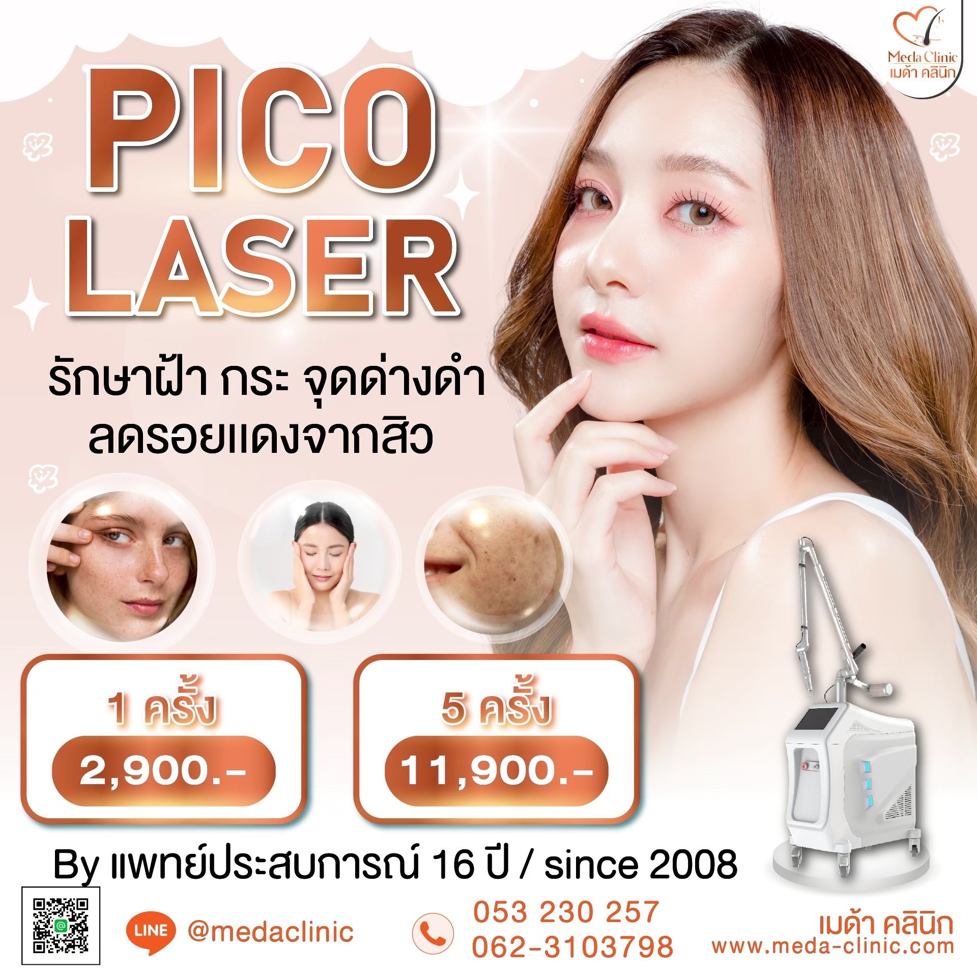 Pico Laser