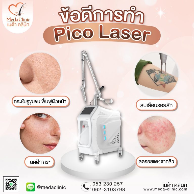 Pico Laser