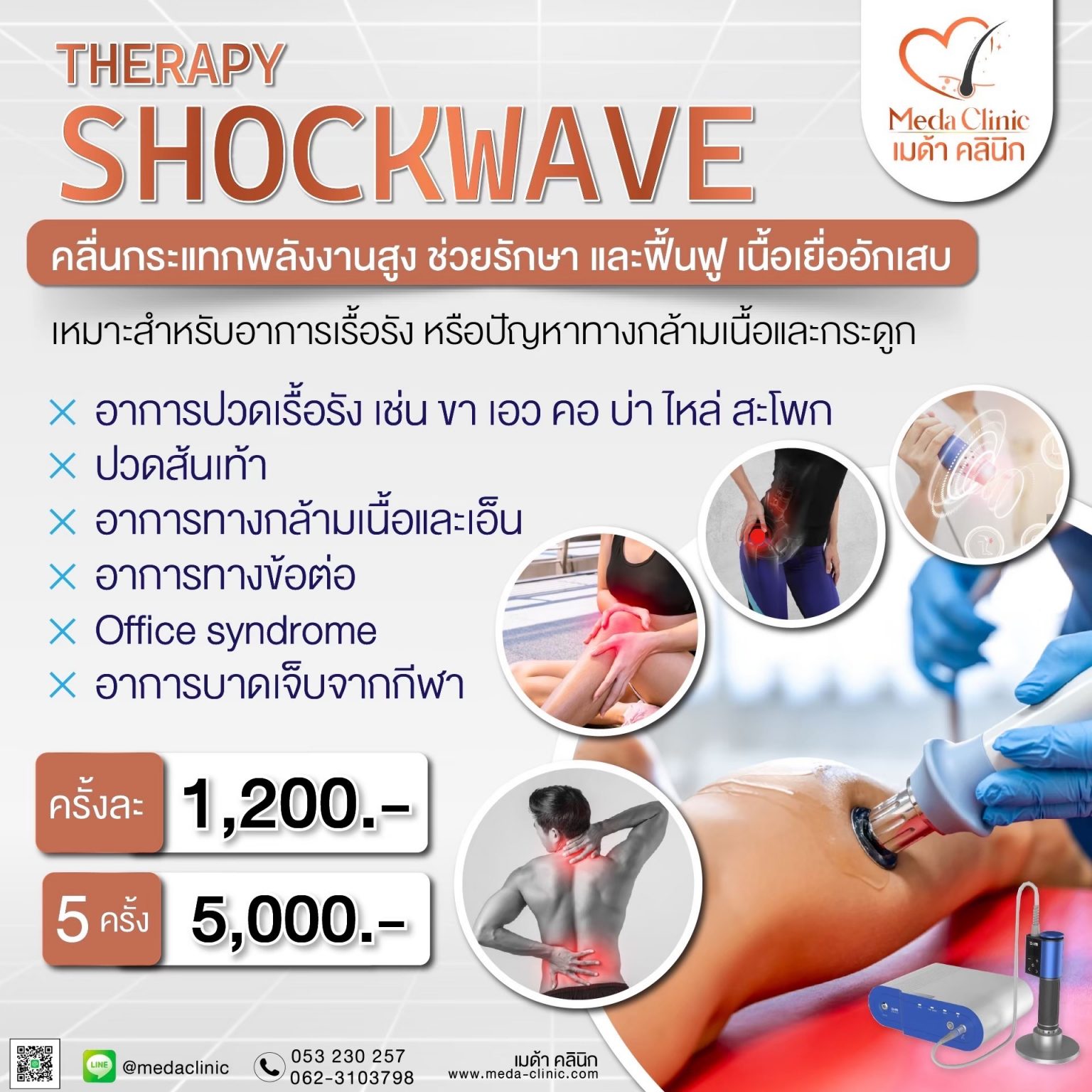 Shock waveที่ไหนดี