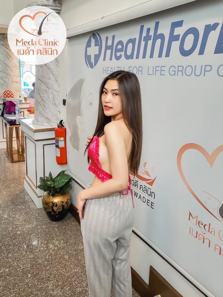 เย็บรูหู