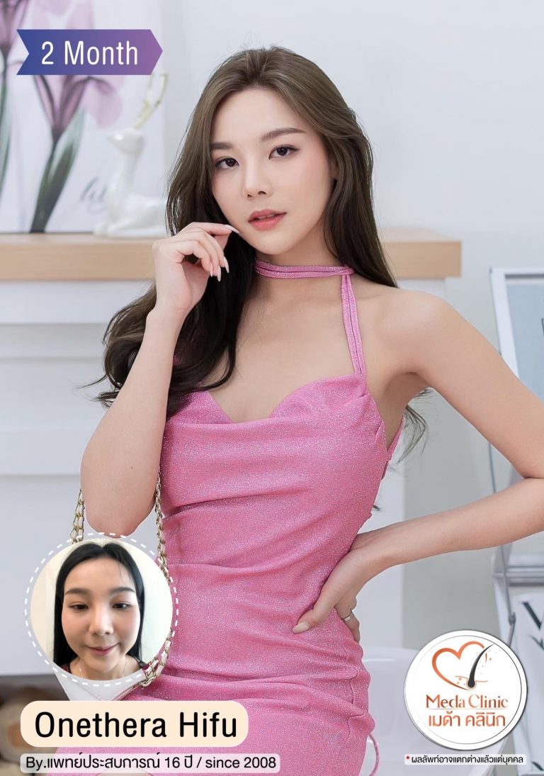 ยกกระชับใบหน้า