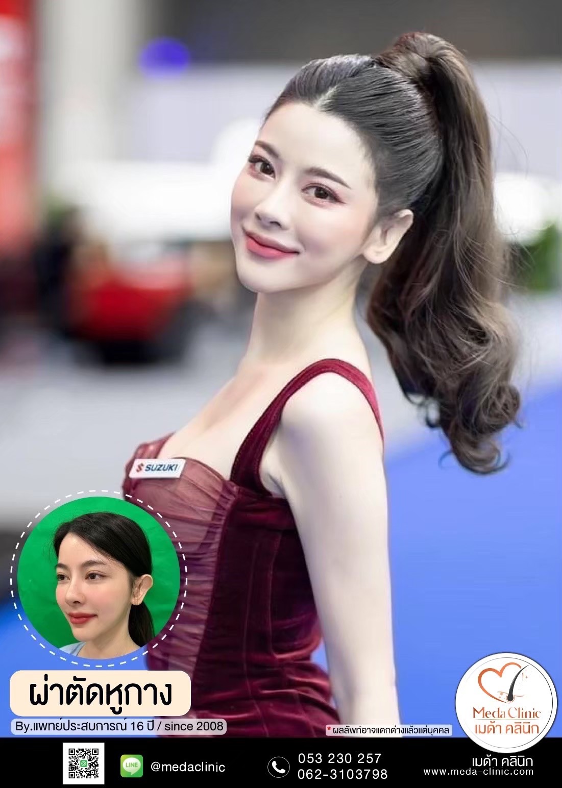 แก้หูกาง