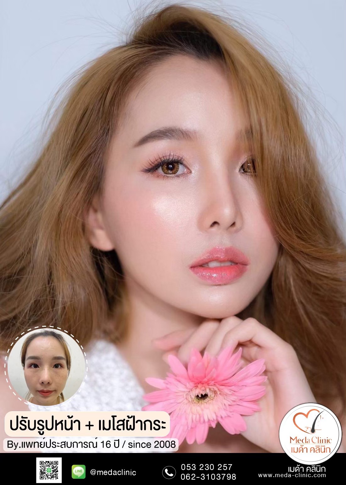 คลินิกฝ้ากระ